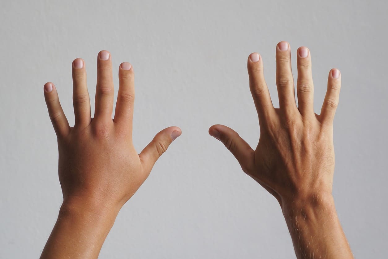 causes-of-swelling-in-the-fingers-healthncure